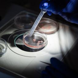 Liquid samples in several lab Petri dishes